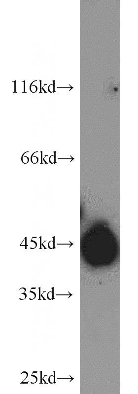 HeLa cells were subjected to SDS PAGE followed by western blot with Catalog No:112563(SLC16A3 antibody) at dilution of 1:1000