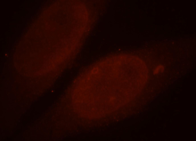 Immunofluorescent analysis of HepG2 cells, using ALLC antibody Catalog No:107860 at 1:25 dilution and Rhodamine-labeled goat anti-rabbit IgG (red).