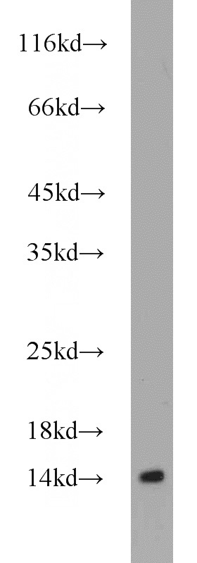 L02 cells were subjected to SDS PAGE followed by western blot with Catalog No:110177(EIF1B antibody) at dilution of 1:300