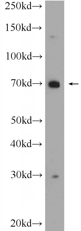 mouse skeletal muscle tissue were subjected to SDS PAGE followed by western blot with Catalog No:108725(C3orf39 Antibody) at dilution of 1:600
