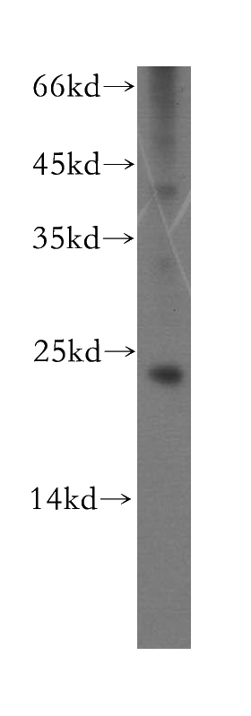 mouse eye tissue were subjected to SDS PAGE followed by western blot with Catalog No:114675(RCVRN antibody) at dilution of 1:400