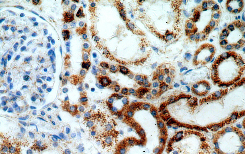 Immunohistochemical of paraffin-embedded human kidney using Catalog No:117061(SLC39A7 antibody) at dilution of 1:100 (under 40x lens)