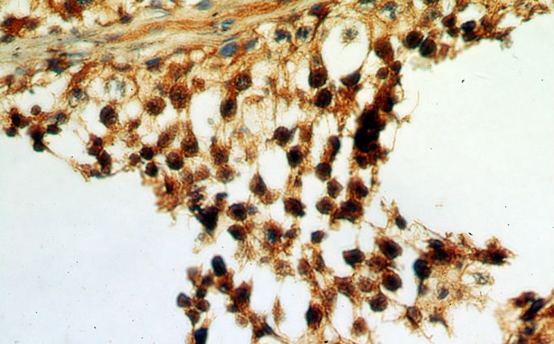 Immunohistochemical of paraffin-embedded human testis using Catalog No:115526(SPA17 antibody) at dilution of 1:50 (under 40x lens)