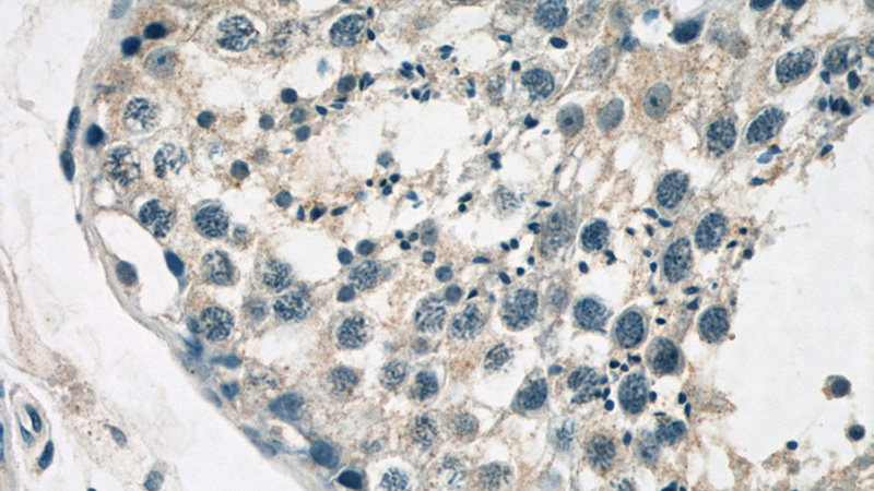 Immunohistochemistry of paraffin-embedded human testis tissue slide using Catalog No:110911(NR6A1 Antibody) at dilution of 1:50 (under 40x lens)
