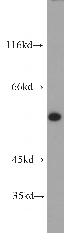 HepG2 cells were subjected to SDS PAGE followed by western blot with Catalog No:112113(KPNA2 antibody) at dilution of 1:1000