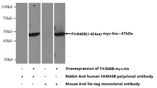 Transfected HEK-293 cells were subjected to SDS PAGE followed by western blot with Catalog No:110589 (FAM46B Antibody) at dilution of 1:1000