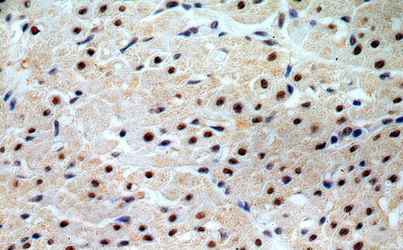 Immunohistochemical of paraffin-embedded human heart using Catalog No:108661(CLE; C14orf166 antibody) at dilution of 1:100 (under 40x lens)