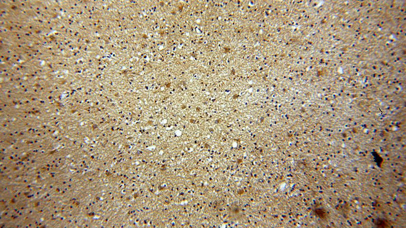 Immunohistochemical of paraffin-embedded human brain using Catalog No:111137(GPRASP1-Specific antibody) at dilution of 1:100 (under 10x lens)