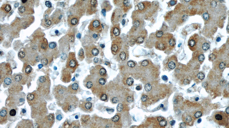 Immunohistochemical of paraffin-embedded human liver using Catalog No:111806(NOS2 antibody) at dilution of 1:50 (under 40x lens)