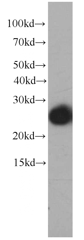 U-937 cells were subjected to SDS PAGE followed by western blot with Catalog No:107067(ARHGDIB antibody) at dilution of 1:1000