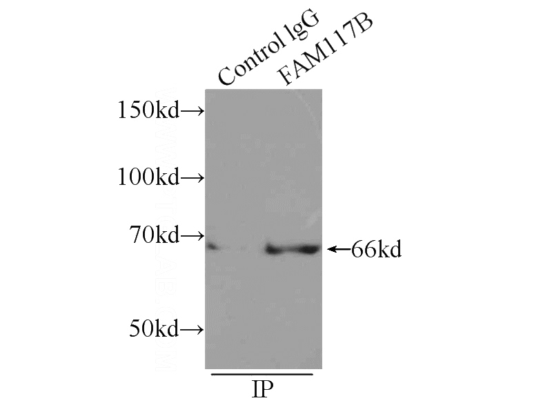 IP Result of anti-FAM117B (IP:Catalog No:110462, 4ug; Detection:Catalog No:110462 1:500) with HEK-293 cells lysate 920ug.