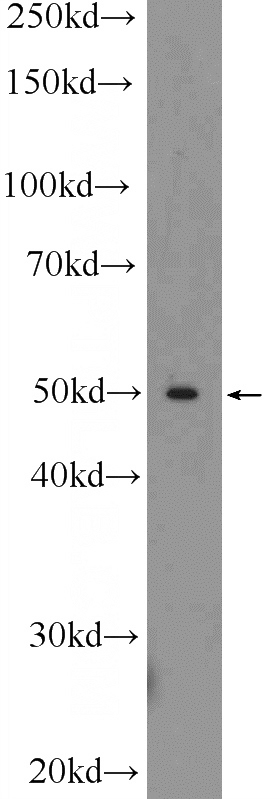 mouse liver tissue were subjected to SDS PAGE followed by western blot with Catalog No:116169 (TOM1 Antibody) at dilution of 1:1000.