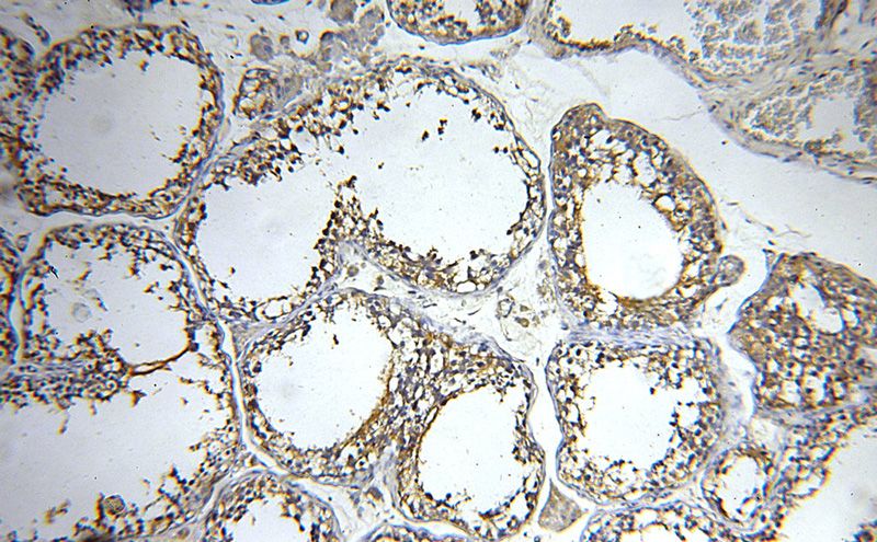 Immunohistochemical of paraffin-embedded human testis using Catalog No:109988(DLEC1 antibody) at dilution of 1:50 (under 10x lens)
