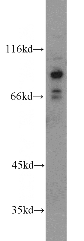 HEK-293 cells were subjected to SDS PAGE followed by western blot with Catalog No:110704(FOXO3A antibody) at dilution of 1:500