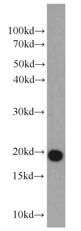 mouse testis tissue were subjected to SDS PAGE followed by western blot with Catalog No:110010(DR1 antibody) at dilution of 1:1000
