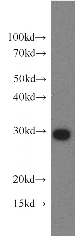 HeLa cells were subjected to SDS PAGE followed by western blot with Catalog No:114377(PSMA7 antibody) at dilution of 1:1000