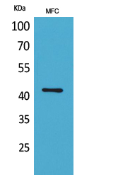Western Blot analysis of MFC cells using α-SMA Polyclonal Antibody. Secondary antibody was diluted at 1:20000
