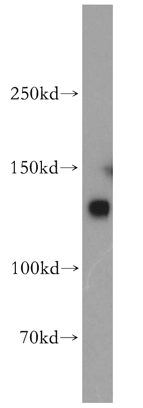 HepG2 cells were subjected to SDS PAGE followed by western blot with Catalog No:110077(LIG1 antibody) at dilution of 1:500