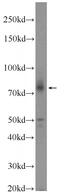 mouse cerebellum tissue were subjected to SDS PAGE followed by western blot with Catalog No:107803(ABCD2 Antibody) at dilution of 1:300