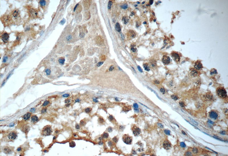 Immunohistochemistry of paraffin-embedded human testis tissue slide using Catalog No:116895(YTHDF2 Antibody) at dilution of 1:50 (under 40x lens)