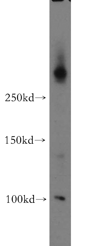mouse thymus tissue were subjected to SDS PAGE followed by western blot with Catalog No:107680(ABCA2 antibody) at dilution of 1:500