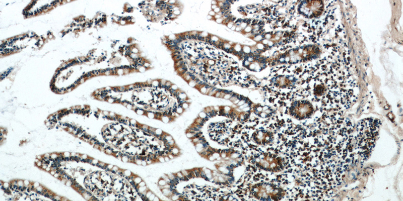 Immunohistochemical of paraffin-embedded human small intestine using Catalog No:110915(MOGS antibody) at dilution of 1:100 (under 10x lens)