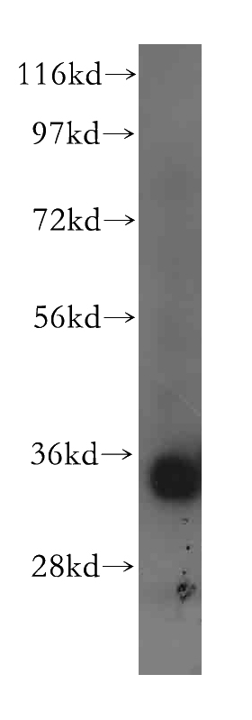 mouse liver tissue were subjected to SDS PAGE followed by western blot with Catalog No:107756(ACY3 antibody) at dilution of 1:400