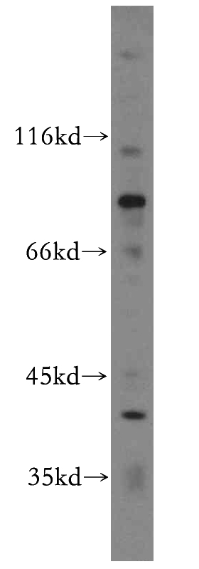 HepG2 cells were subjected to SDS PAGE followed by western blot with Catalog No:110241(EML1 antibody) at dilution of 1:300