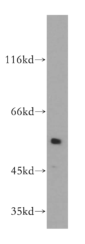 HL-60 cells were subjected to SDS PAGE followed by western blot with Catalog No:108858(CARD9 antibody) at dilution of 1:300