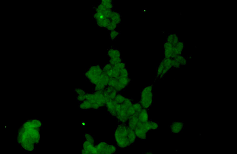 Immunofluorescent analysis of HEK-293 cells using Catalog No:115003(SCML2 Antibody) at dilution of 1:50 and Alexa Fluor 488-congugated AffiniPure Goat Anti-Rabbit IgG(H+L)