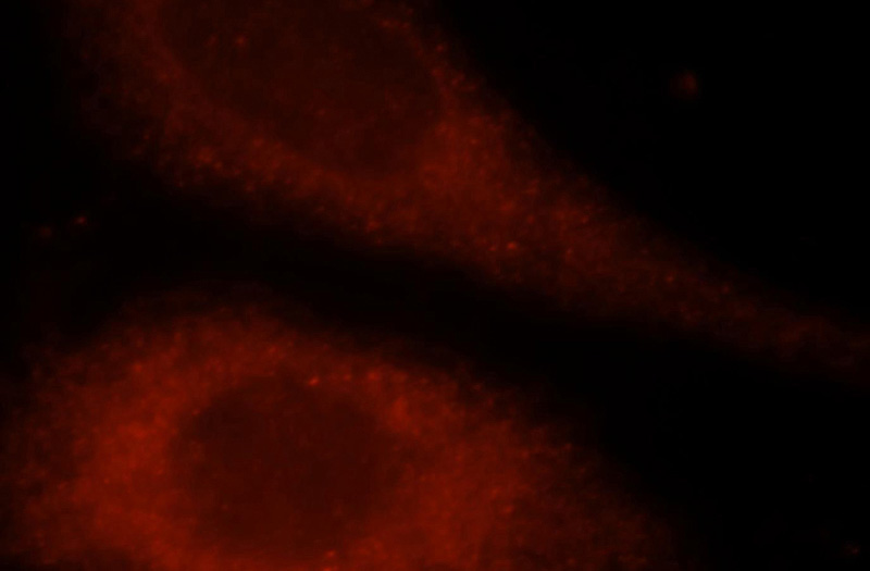 Immunofluorescent analysis of Hela cells, using TK1 antibody Catalog No:116067 at 1:25 dilution and Rhodamine-labeled goat anti-rabbit IgG (red).