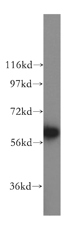 HeLa cells were subjected to SDS PAGE followed by western blot with Catalog No:115420(SMAD4 antibody) at dilution of 1:1200