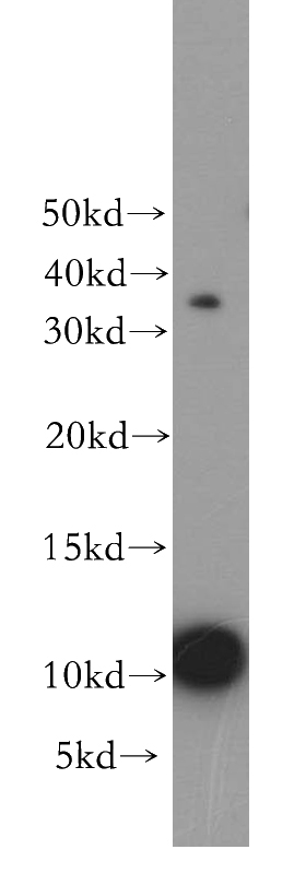 human spleen tissue were subjected to SDS PAGE followed by western blot with Catalog No:111362(HIST1H4F antibody) at dilution of 1:300