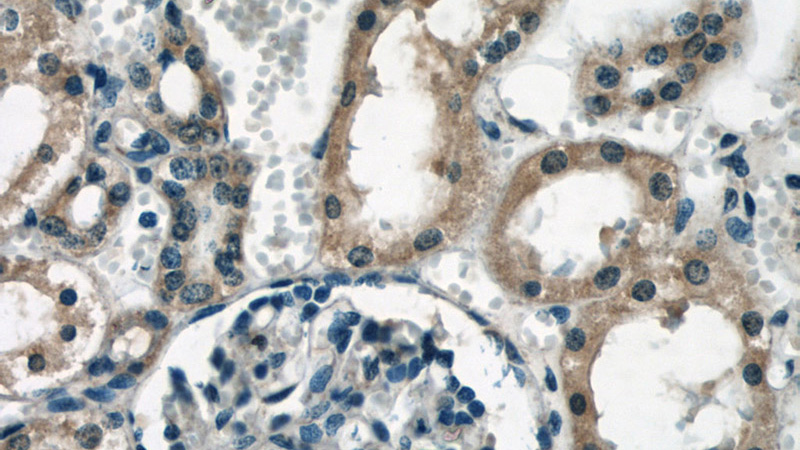 Immunohistochemical of paraffin-embedded human kidney using Catalog No:114951(RYK antibody) at dilution of 1:50 (under 40x lens)