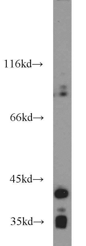 HeLa cells were subjected to SDS PAGE followed by western blot with Catalog No:107649(NKX2-1 antibody) at dilution of 1:1000