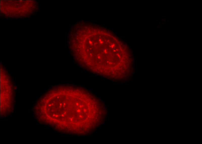 Immunofluorescent analysis of HeLa cells using Catalog No:115928(TDRD3 Antibody) at dilution of 1:25 and Rhodamine-Goat anti-Rabbit IgG