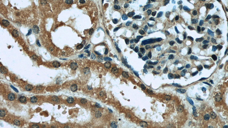 Immunohistochemical of paraffin-embedded human kidney using Catalog No:111149(GPX4 antibody) at dilution of 1:50 (under 40x lens)