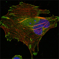 Confocal immunofluorescence analysis of Hela cells using LPP mouse mAb (green). Red: Actin filaments have been labeled using DY-554 phalloidin. Blue: DRAQ5 fluorescent DNA dye.