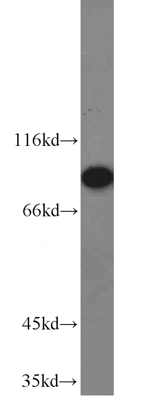 HeLa cells were subjected to SDS PAGE followed by western blot with Catalog No:114923(RRM1 antibody) at dilution of 1:2000