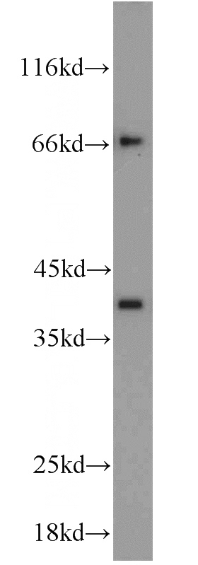 mouse brain tissue were subjected to SDS PAGE followed by western blot with Catalog No:115792(STX12 antibody) at dilution of 1:1000