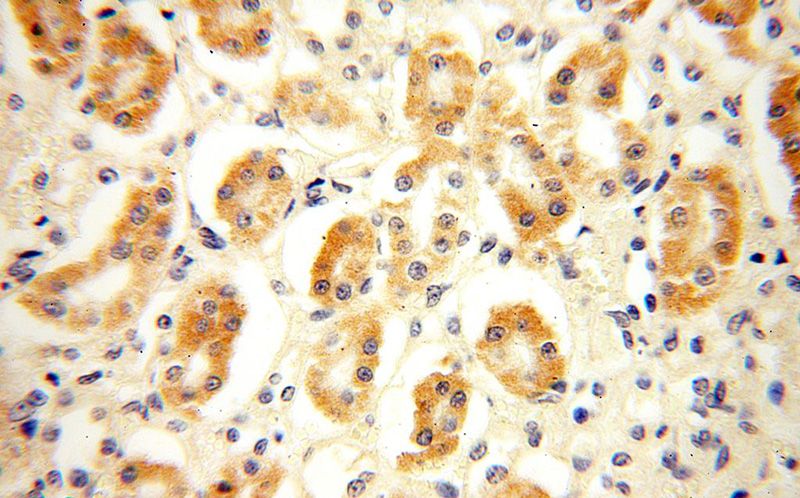 Immunohistochemical of paraffin-embedded human kidney using Catalog No:113069(NDUFB1 antibody) at dilution of 1:100 (under 40x lens)