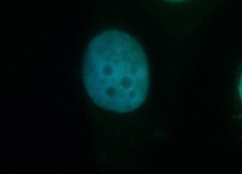 Immunofluorescent analysis of Hela cells, using CRTC2 antibody Catalog No:109581 at 1:50 dilution and FITC-labeled donkey anti-rabbit IgG (green). Blue pseudocolor = DAPI (fluorescent DNA dye).