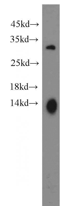 mouse brain tissue were subjected to SDS PAGE followed by western blot with Catalog No:116849(LAT2 antibody) at dilution of 1:1000