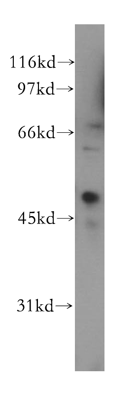 HL-60 cells were subjected to SDS PAGE followed by western blot with Catalog No:109549(CREB3L4 antibody) at dilution of 1:500