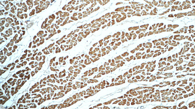 Immunohistochemistry of paraffin-embedded human heart tissue slide using Catalog No:112942(MYL2 Antibody) at dilution of 1:50 (under 10x lens)