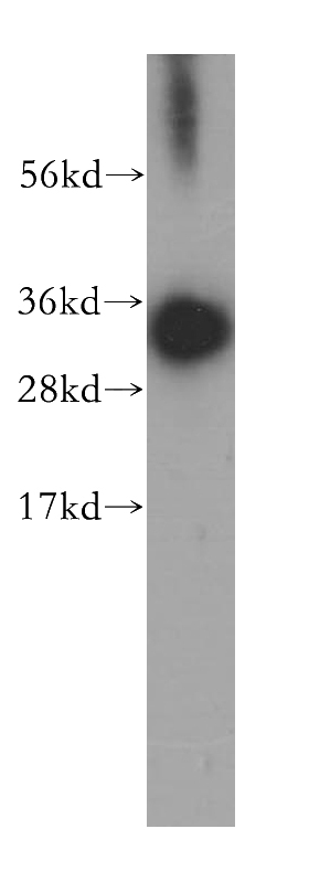 HeLa cells were subjected to SDS PAGE followed by western blot with Catalog No:111503(HNRNPC antibody) at dilution of 1:500