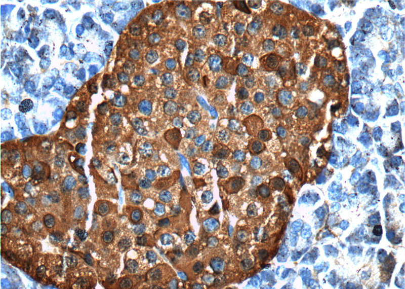 Immunohistochemistry of paraffin-embedded human pancreas tissue slide using Catalog No:115499(SST-Specific Antibody) at dilution of 1:200 (under 40x lens).