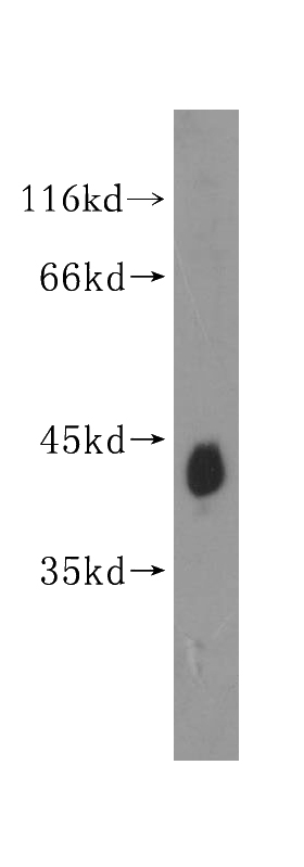 human brain tissue were subjected to SDS PAGE followed by western blot with Catalog No:115119(SEPT5 antibody) at dilution of 1:800