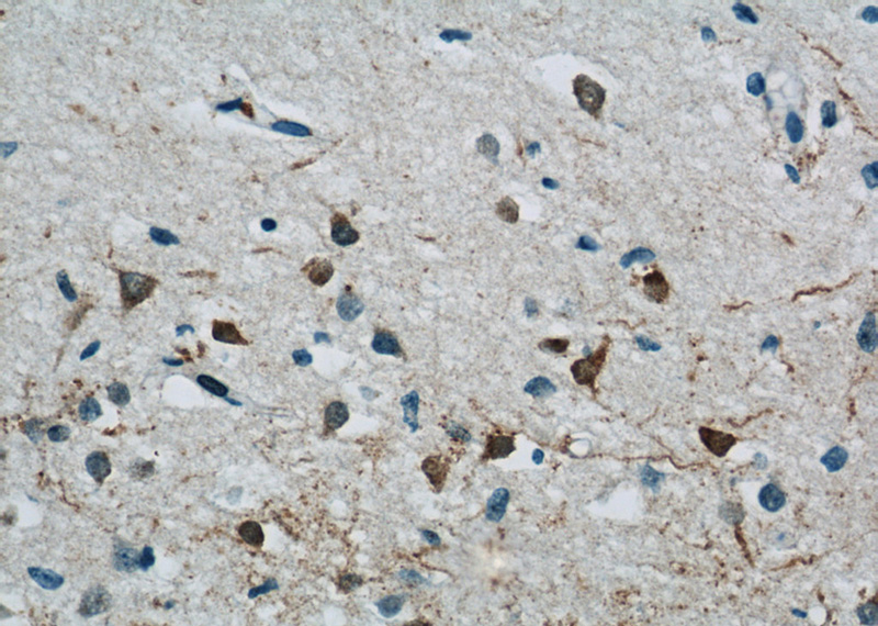 Immunohistochemistry of paraffin-embedded human brain tissue slide using Catalog No:112755(MPPED2 Antibody) at dilution of 1:50 (under 40x lens)