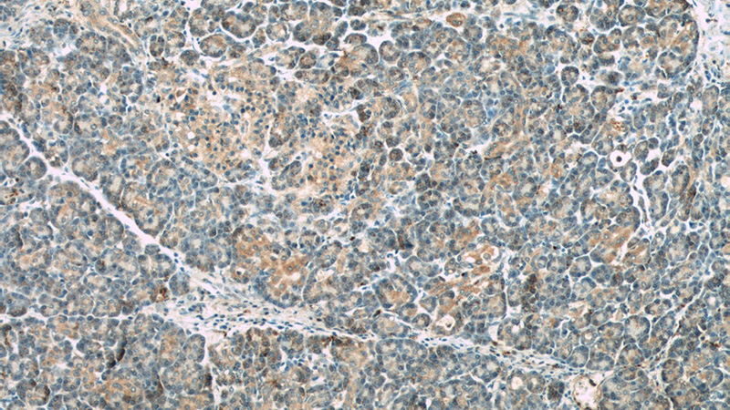 Immunohistochemical of paraffin-embedded human pancreas using Catalog No:116036(THADA antibody) at dilution of 1:50 (under 10x lens)